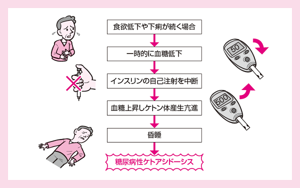 糖尿病性ケトアシドーシス